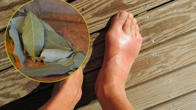 Inilah Cara Guna Daun Salam Untuk Merawat Kencing Manis Dan Kolesterol