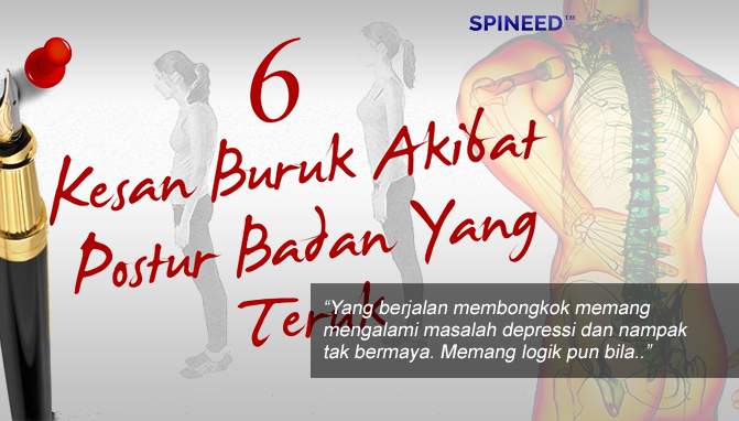 Inilah 6 Kesan Buruk Akibat Postur Badan Yang Teruk