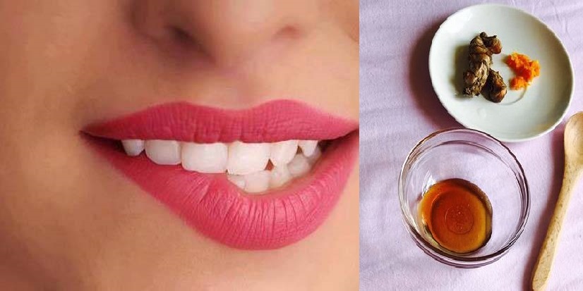Guna Kunyit Dan Madu Jika Mahu Bibir Cantik Dan Tidak Merekah