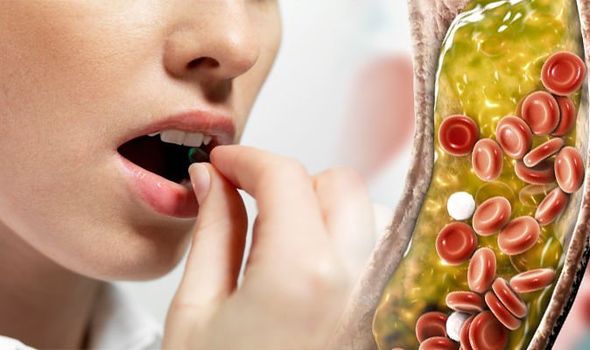 Ini Sebenarnya Punca Kolestrol Dalam Badan Menjadi Tinggi Yang Masih Ramai Tak Tahu