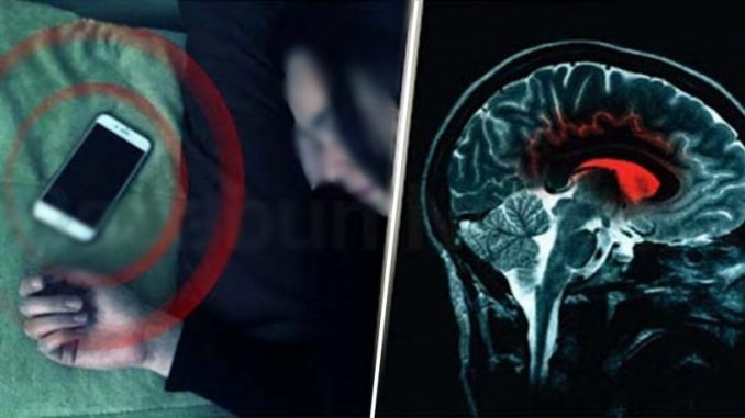 Selalu Tertidur Dengan Handphone Di Kepala? Awas, Lihat Kesan Ini Kepada Otak Anda