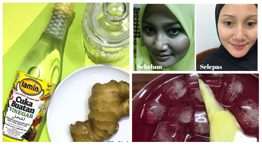Tip Dapatkan Kulit Flawless Dengan Halia & Cuka. Jimat, Tak Payah Pergi Spa