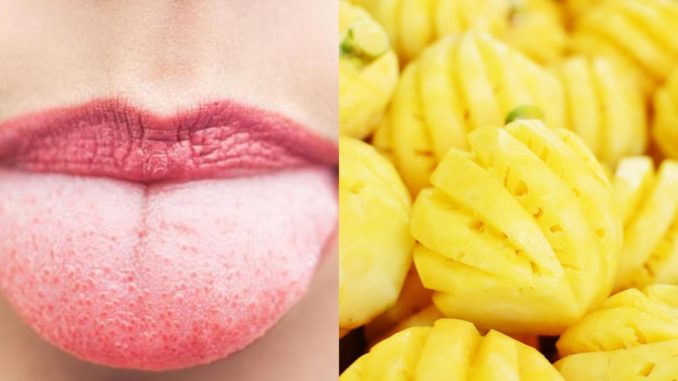 Kenapa Lidah G4tal Selepas Makan Nanas? Ini Cara Untuk Atasinya