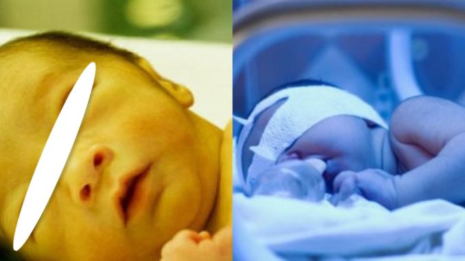 Bayi Kerap Tidur Boleh Terdedah Dengan Demam Kuning? Ini Tips Untuk Kejutkan Bayi Agar Menyusu
