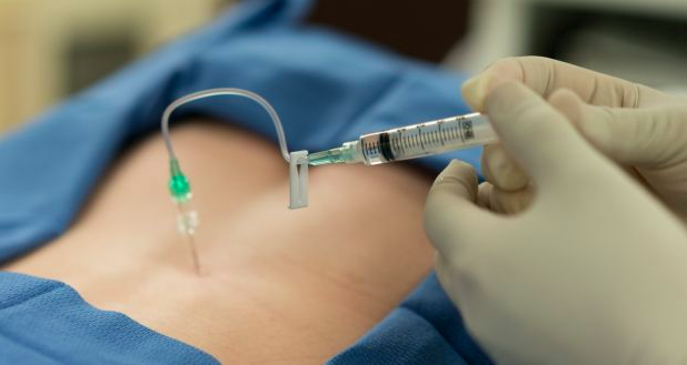 Sakit Bersalin Bukan Main-Main. Doktor Kongsi Pentingnya Ambil Suntikan Epidural